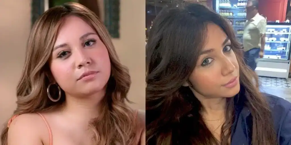 Face-Before-And-After-Weight-Loss